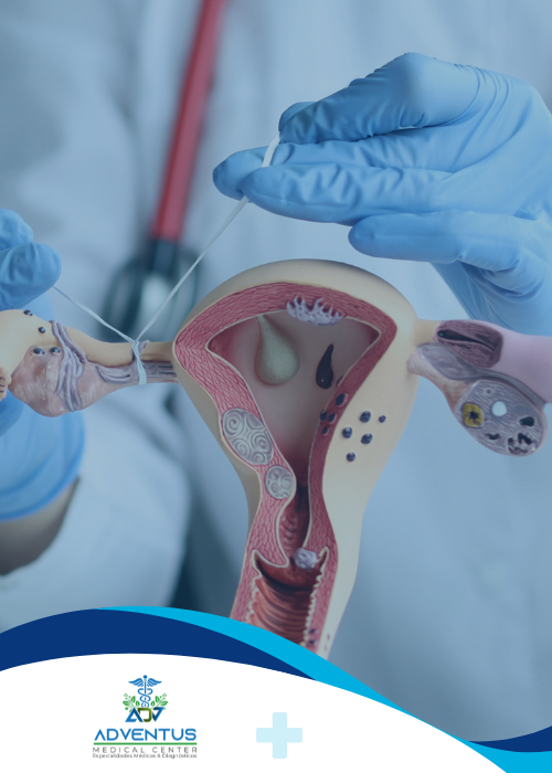Ligadura de Varices esofagicas Adventus Medical Center